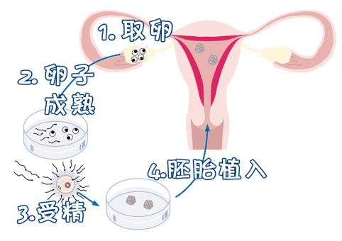 胚胎专家